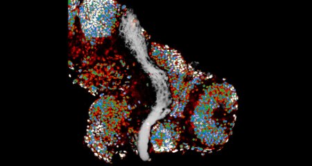 091916_ls_axon_main_0